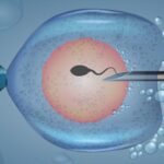 IVF Treatment